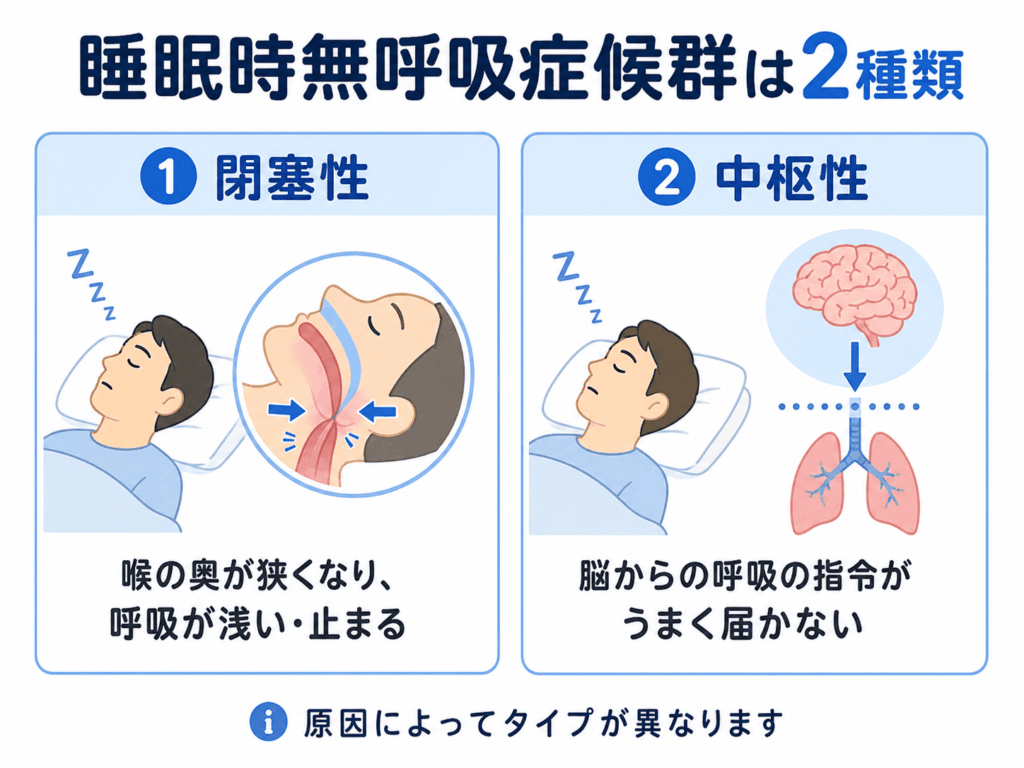 睡眠時無呼吸症候群の種類