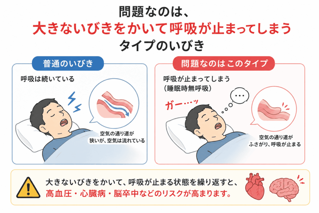 問題になるいびきとは