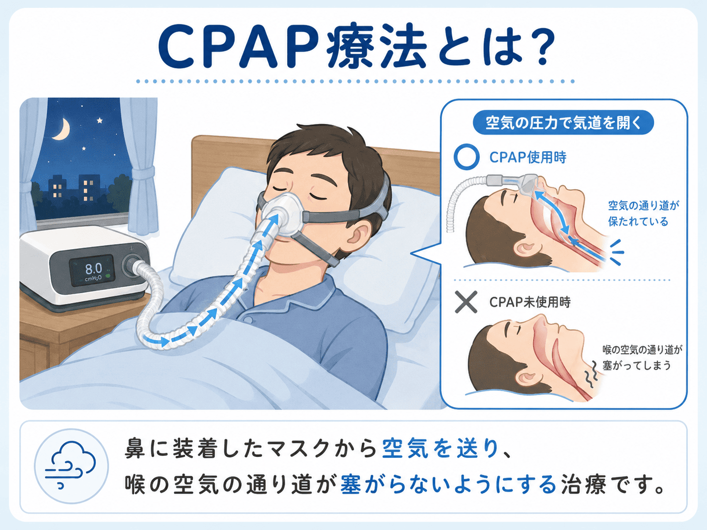 睡眠 時 無 呼吸 症候群 治療