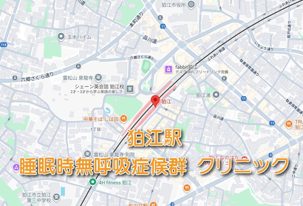 狛江駅（小田急線）周辺の睡眠時無呼吸症候群・いびき外来クリニック