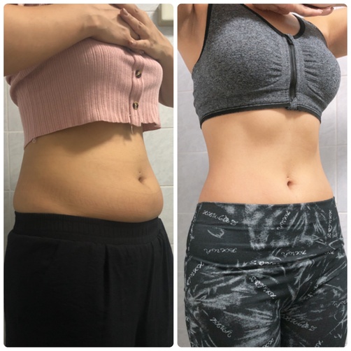 当院でのマンジャロ治療効果