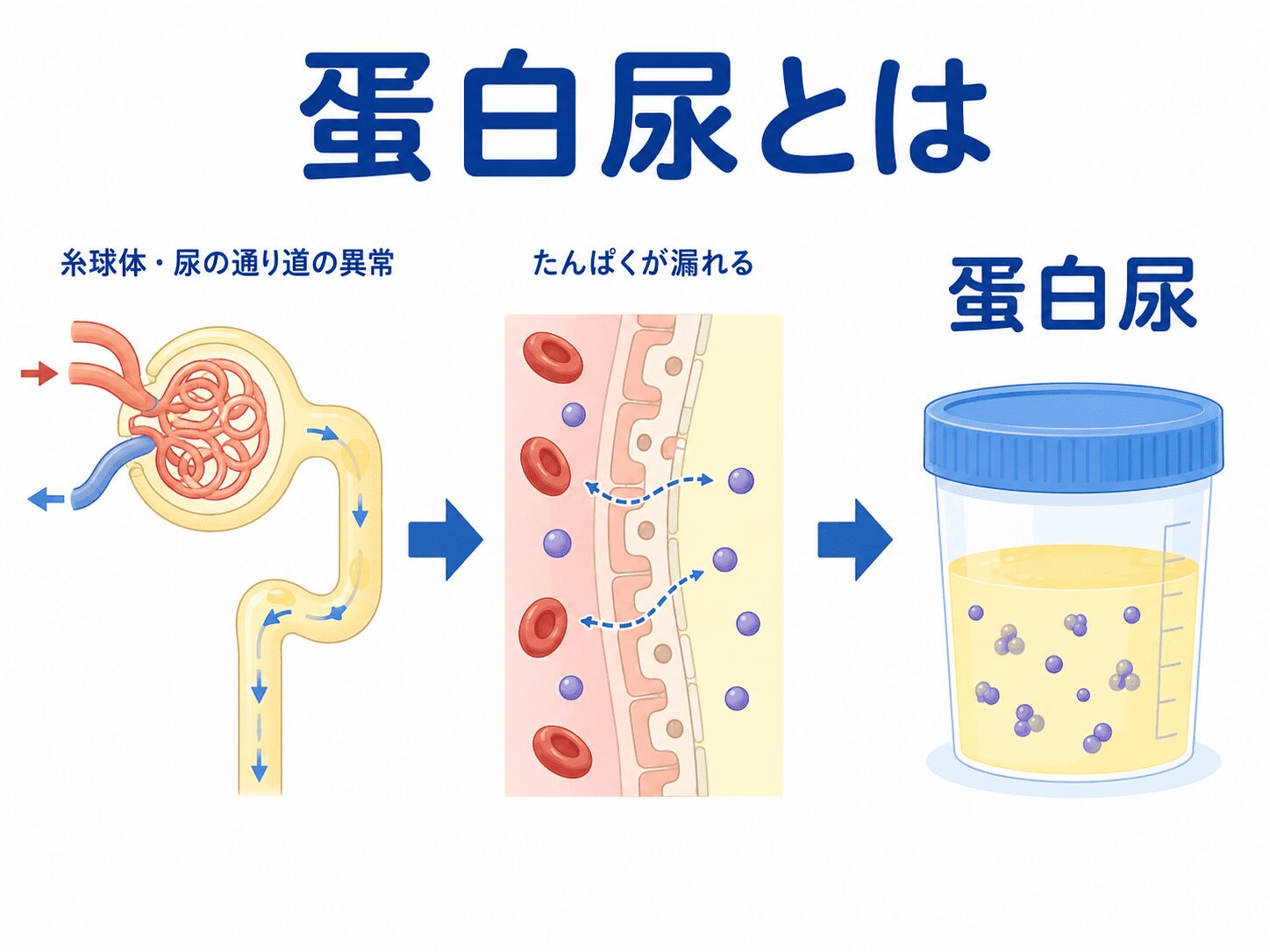 【調布で腎臓内科をお探しの方へ】健診で尿蛋白を指摘されたら 1 蛋白尿とは(調布・三鷹からアクセス良好)