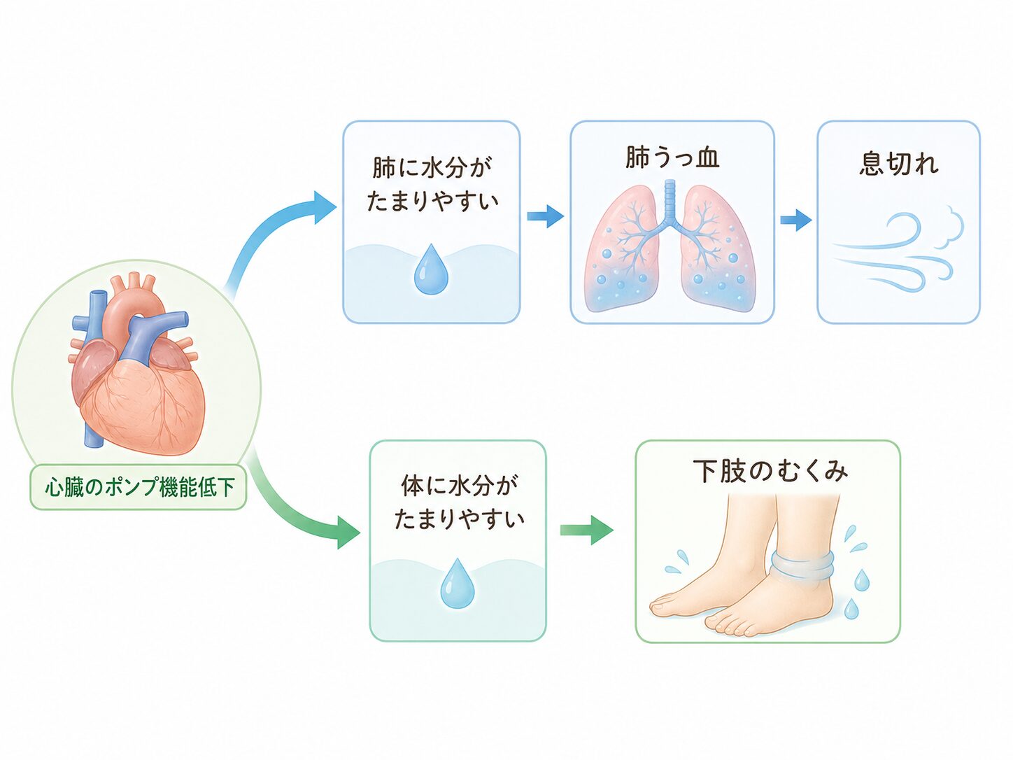 息切れ・むくみ・心不全が気になる方へ|調布市の循環器内科 2 心臓のポンプ機能が低下し肺や足に水分がたまる仕組みの図