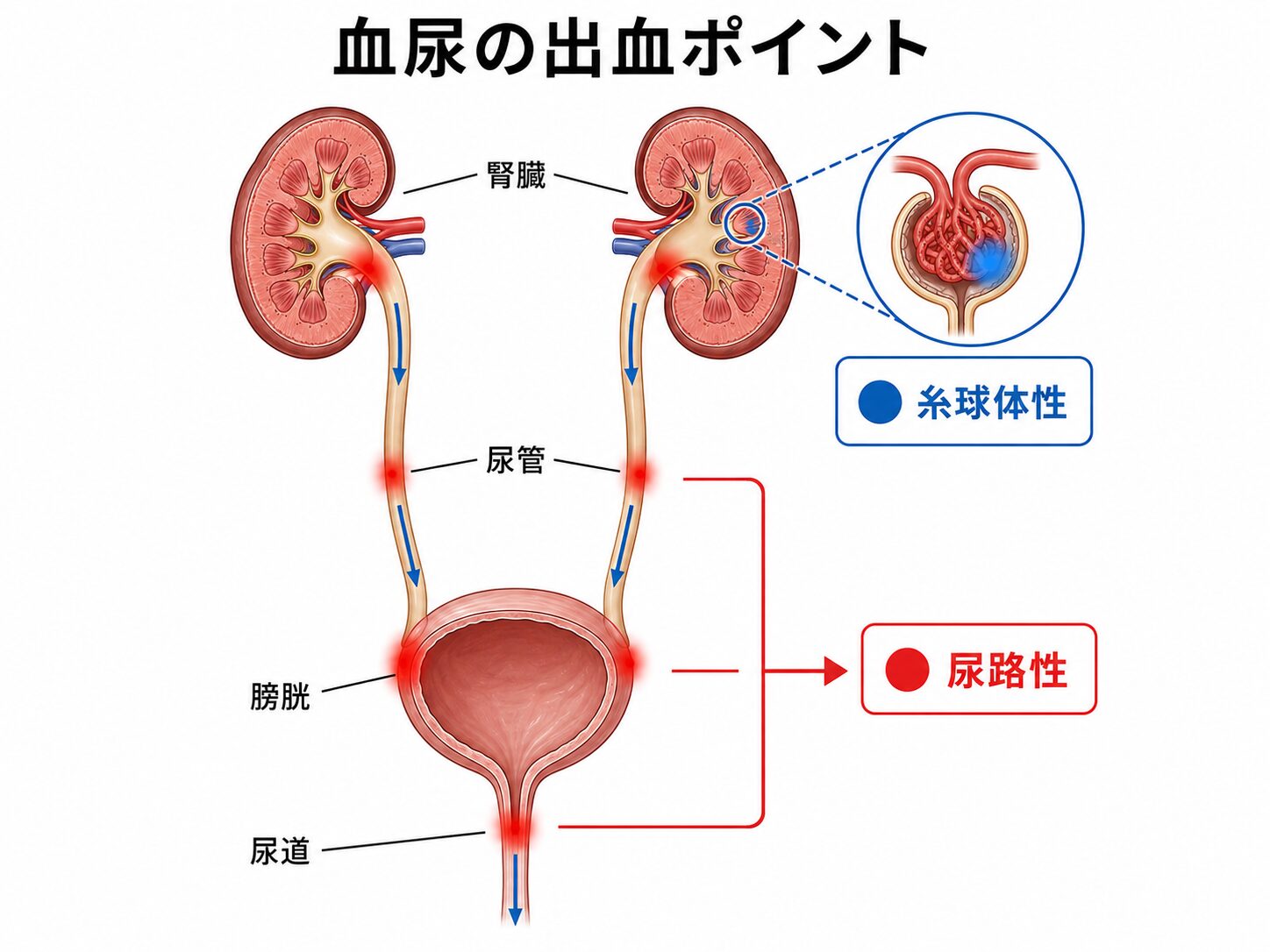 尿潜血・血尿|健診で指摘された方へ|調布市の腎臓内科 1 血尿が生じる部位(糸球体性血尿と尿路性血尿)